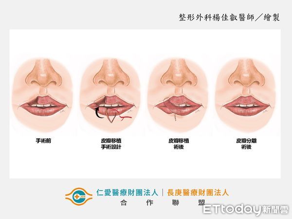 ▲大里仁愛醫院整形外科醫師楊佳叡。（圖／台中大里仁愛醫院提供）