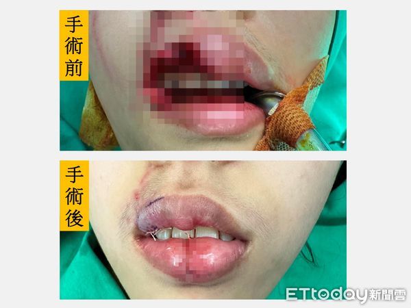 ▲大里仁愛醫院整形外科醫師楊佳叡。（圖／台中大里仁愛醫院提供）