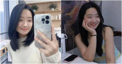 27歲女遭毒蛇咬傷!醫院瞎忙4小時「只打食鹽水」...轉診後不治