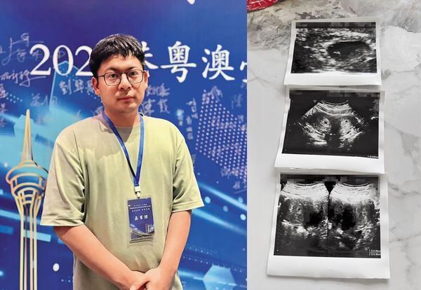 A女因聽到男友喬天鼎（左圖）的偷吃傳聞，影響情緒而流產。右圖為她當時懷孕的超音波。（翻攝自《羊城晚報》／讀者提供）