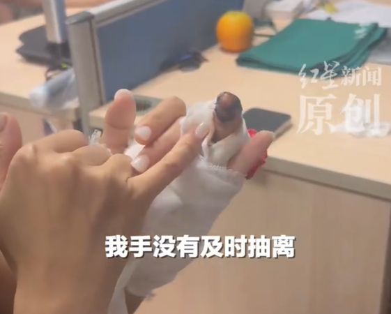 ▲▼女子美甲太厚感知失靈。（圖／翻攝自微博）
