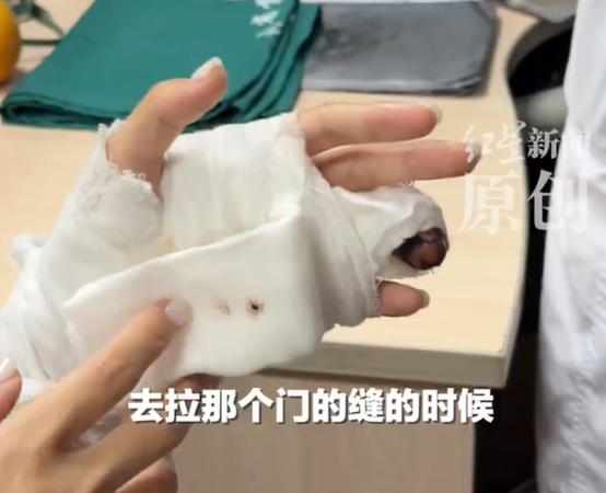 ▲▼女子美甲太厚感知失靈。（圖／翻攝自微博）