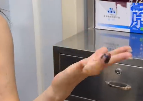 ▲劉佳的手指被門夾到。（圖／翻攝自微博）