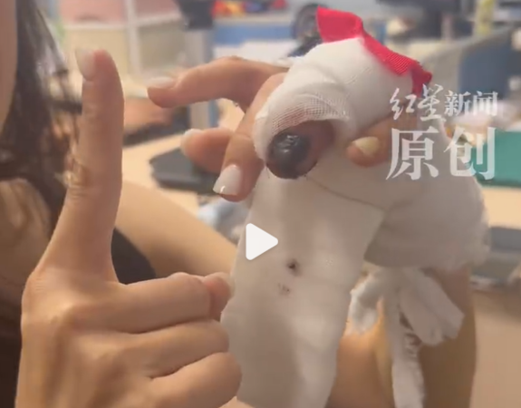 ▲▼女子美甲太厚感知失靈。（圖／翻攝自微博）