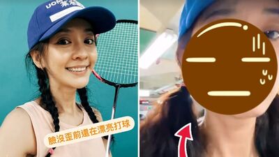 陳意涵做完臉「走一走突然就歪了」！保養出包…正面對比照超驚悚