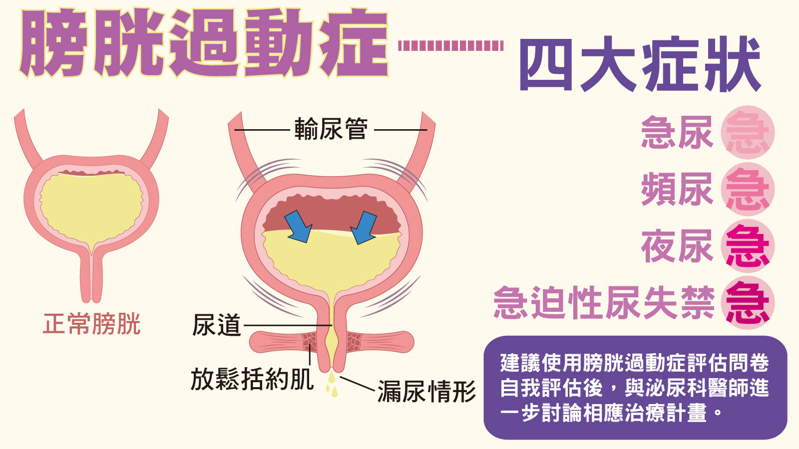 ▲▼膀胱過動症4大症狀。（圖／振興醫院提供）