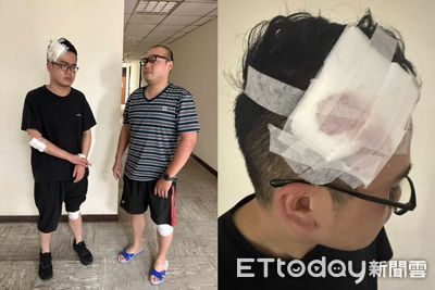 通緝犯撞臨檢站!被12槍擊斃 27歲警被撞倒地...奮勇開槍還擊