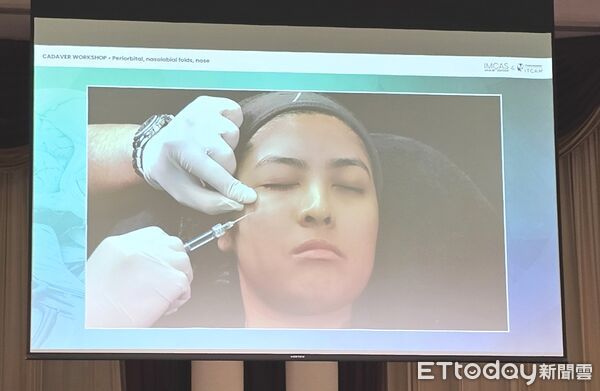 ▲藝群集團董事長王正坤醫師赴泰國曼谷參與IMCAS Asia 2025醫學美容大會，與國際專家交流韌帶拉提新技術。（記者林東良翻攝，下同）