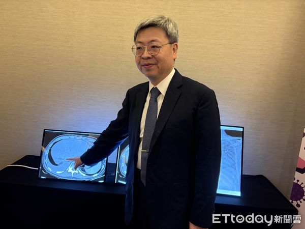 ▲▼感染管制學會與感染症醫學會示警抗生素抗藥性問題，新竹台大分院新竹醫院副院長盛望徽。（圖／記者洪巧藍攝）