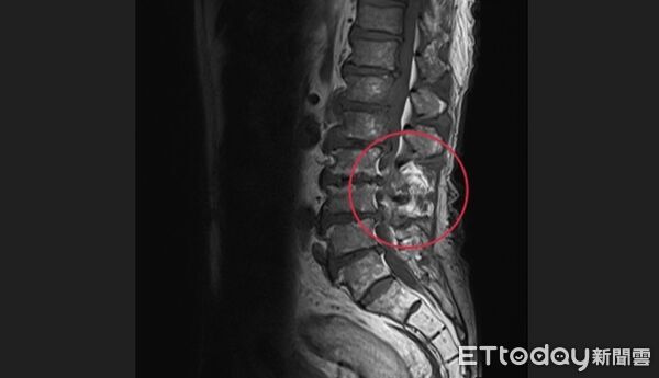 ▲亞大附醫,張為碩,感染科。（圖／亞大附醫提供）