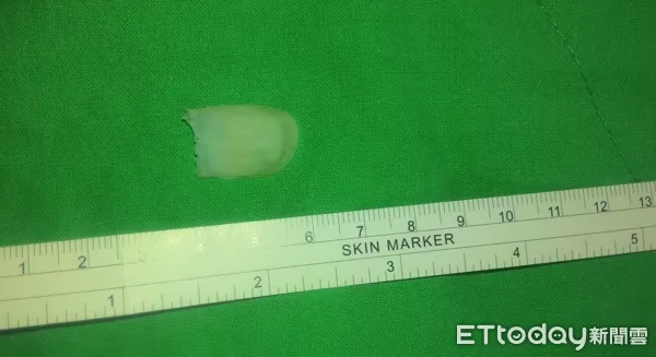 ▲▼     黃培銘        。（圖／黃培銘醫師提供）