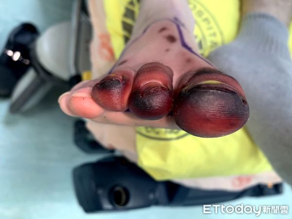 ▲▼            馬陸 。（圖／陳慶恩醫師提供）