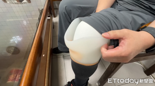 ▲▼雲林追逐車禍遭撞，陳男左膝以下截肢。（圖／記者游瓊華翻攝）