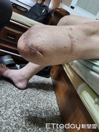 ▲▼雲林追逐車禍遭撞，陳男左膝以下截肢。（圖／記者游瓊華翻攝）