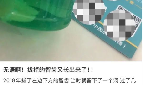 ▲▼ 大陸一名女子拔智齒後又長出來            。（圖／翻攝 九派新聞）