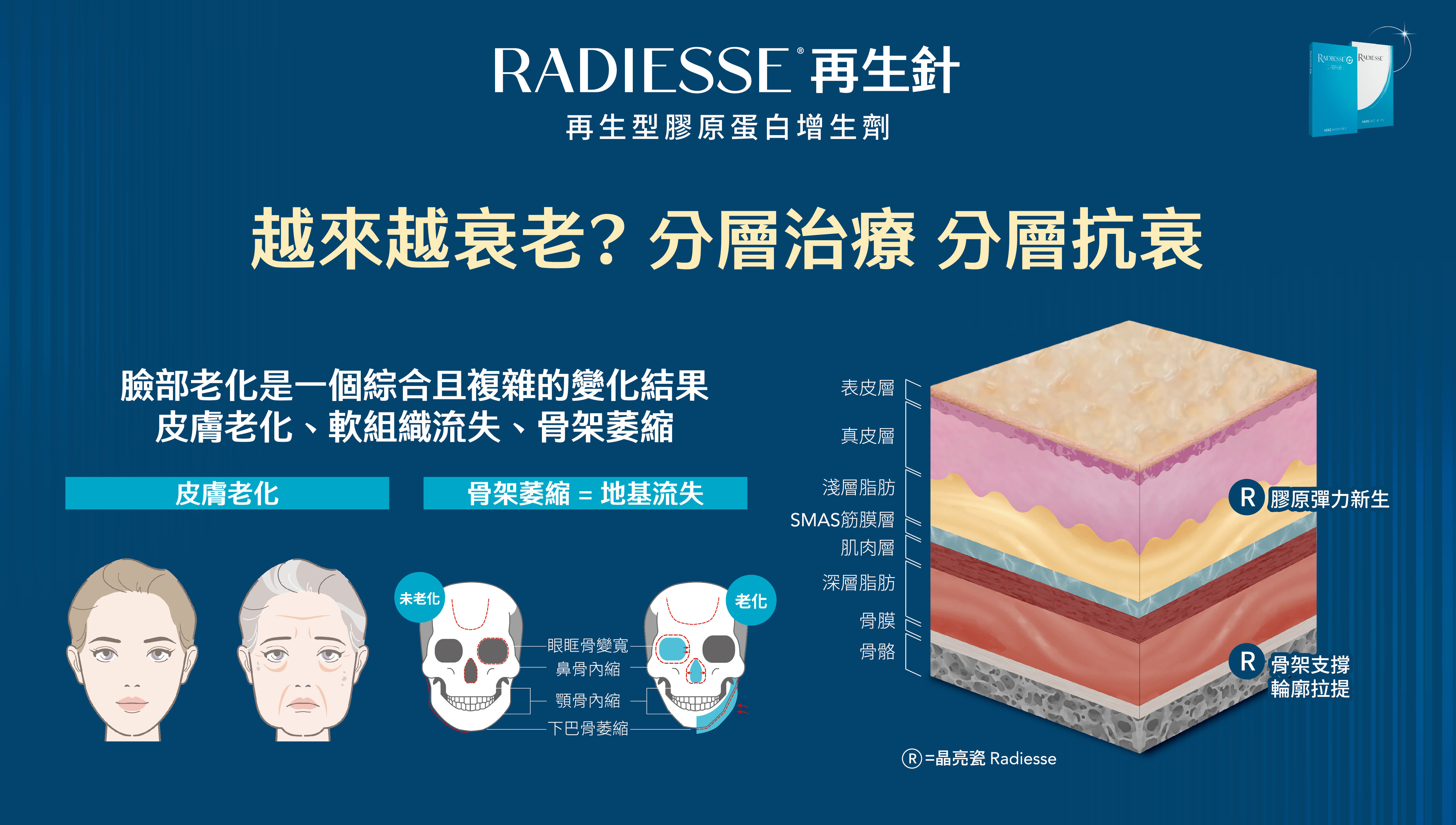 ▲▼醫美,撞臉,韓國,再生針,Radiesse,膠原蛋白,玻尿酸,微整。（圖／光澤診所提供）
