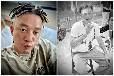 阿Ben拍戲受傷「白衣全是血」！　首曝傷勢照頭縫數針