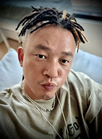 ▲白吉勝在拍戲時不慎發生意外，緊急送醫縫合。（圖／翻攝自Facebook／白吉勝&徐小可 Love 白宮這一家 Pai’s Family）