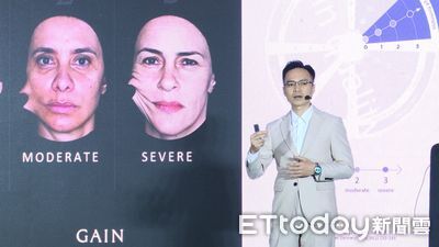 4D童妍針推出「肌膚再生之鑰」療程自由搭配  精準客製化美麗