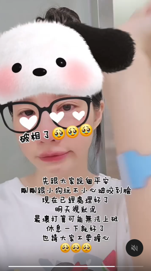 ▲▼筠熹遭愛犬咬傷臉！曬濺血照「差點傷到眼球」。（圖／翻攝自Threads／yuhi_0927）