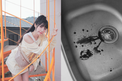 筠熹遭愛犬咬傷臉！　曬濺血照「差點傷到眼球」破相急停工