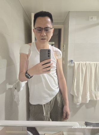 ▲486先生曾因肩膀沾黏問題接受微創手術。（圖／翻攝自Facebook／陳延昶）