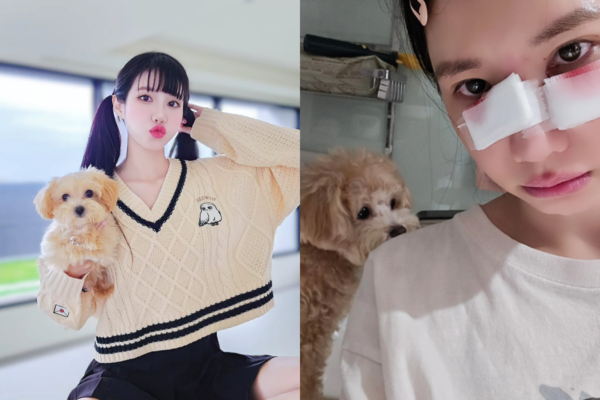 ▲▼筠熹遭愛犬咬臉2天宣布復工！親揭狗狗暴走原因。（圖／翻攝自筠熹Instagram及Threads）