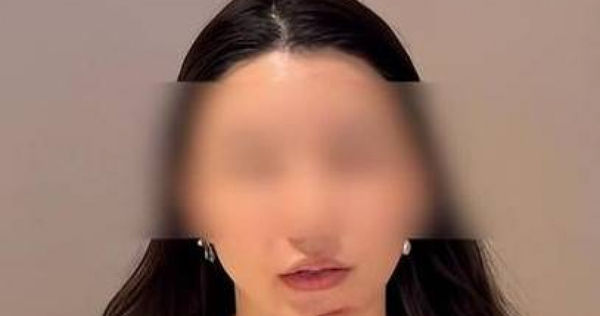 南京一名女子整形失敗，修復手術反而更加嚴重。（圖／翻攝自揚子晚報）