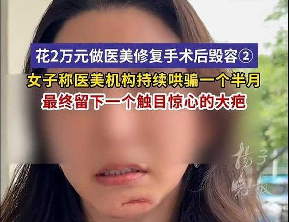 丁女術後面部「饅化」腫脹（圖／翻攝自揚子晚報）