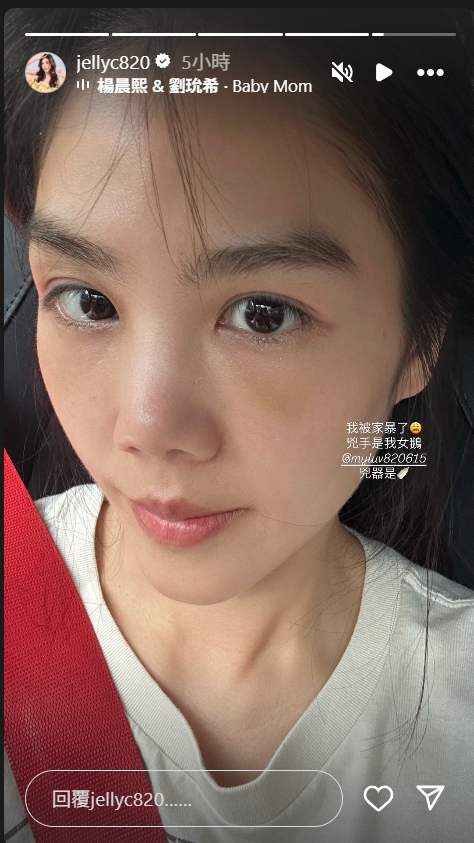 ▲▼楊晨熙眼下驚現大片瘀青！揭發「兇手」喊：被家暴了。（圖／翻攝自Instagram／jellyc820）