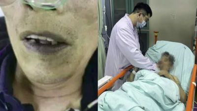 陸翁吃自製榨菜「暈倒發紫」　送醫發現「亞硝酸鹽中毒」