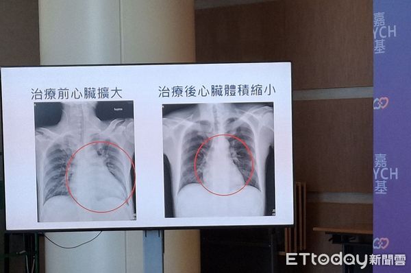 ▲▼  嘉基與扶輪社合力推動公益篩檢成果豐碩   。（圖／嘉義基督教醫院提供）