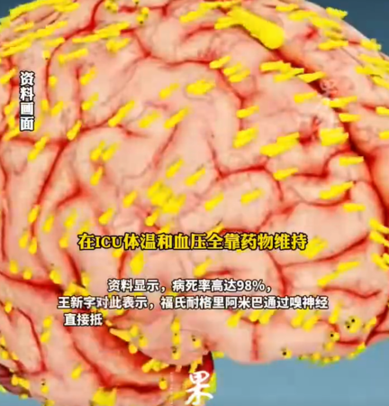 ▲食腦蟲繁殖速度極快。（示意圖／翻攝自微博）
