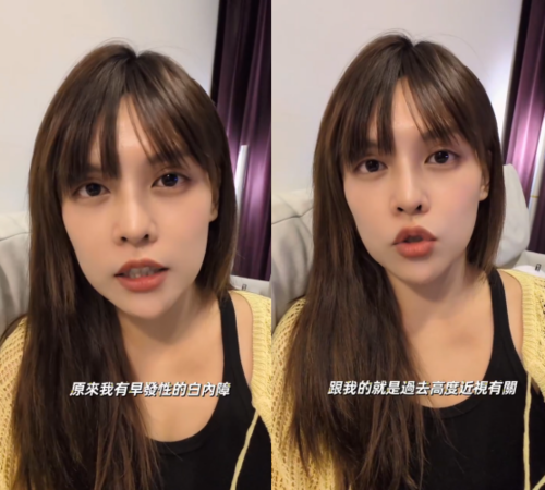 ▲▼夏宇童36歲被診斷出「早發性白內障」醫曝3原因。（圖／翻攝自Instagram／sha_ariel）