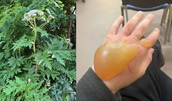 大豬草近期疑似在北海道札幌市多處現蹤，引發當地政府高度警戒。（翻攝自X）