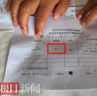 ▲▼甘肅幼稚園爆「集體鉛中毒」　孩童「掉髮、黑牙齒」血鉛超標3倍。（圖／翻攝微博）