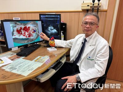 六旬突婦肢體癱軟！醫揪出5公分「心臟黏液瘤」害血栓