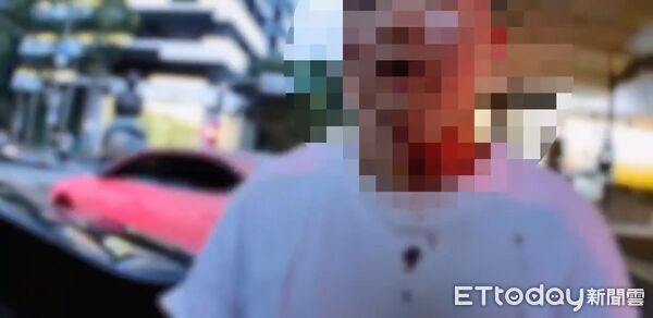 ▲駕駛BMW朱男與義交當街互毆雙方頭臉掛彩。（圖／記者張君豪翻攝）