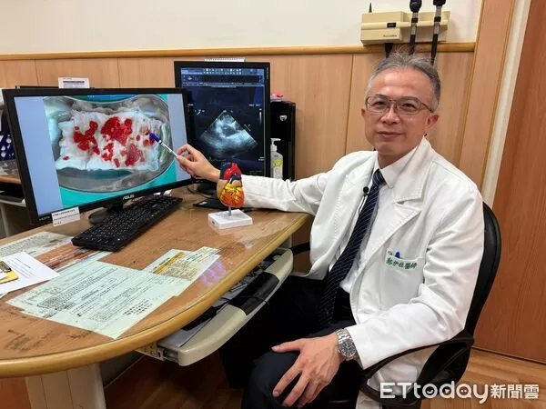 中風竟是心臟黏液瘤作怪。（圖／台北慈濟醫院提供）