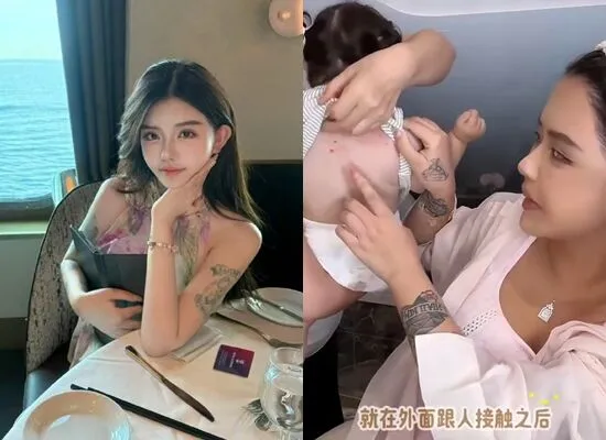 ▲韓安冉女兒蟲卵過敏。（圖／翻攝自韓安冉微博）