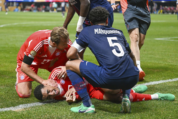 ▲拜仁慕尼黑中場新星穆夏拉（Jamal Musiala）遭遇嚴重傷勢。（圖／達志影像／美聯社）