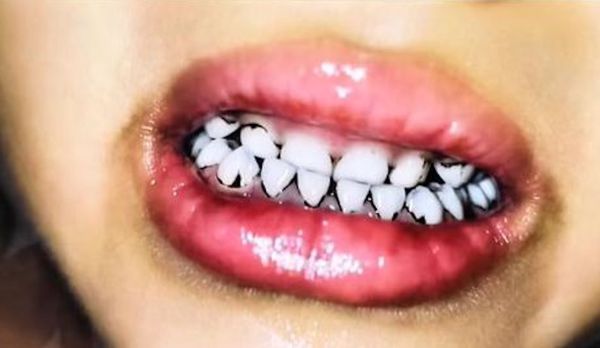 ▲▼ 甘肅天水幼稚園使用顏料加入食物，233名幼兒血鉛異常，幼稚園相關人員八人刑拘。（圖／翻攝 澎湃新聞、央視）