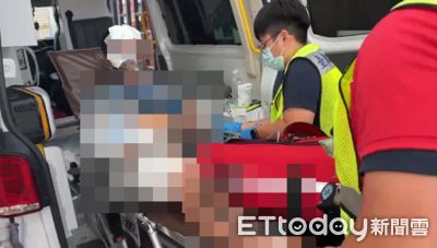 台東男點燃木材「燒到自己」多處燙傷　傷勢嚴重轉送大醫院