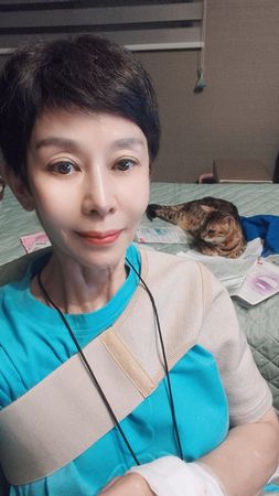 ▲▼《繞著地球跑》李秀媛出車禍！骨裂脫臼送醫。（圖／翻攝自臉書）