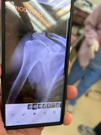 ▲▼《繞著地球跑》李秀媛出車禍！骨裂脫臼送醫。（圖／翻攝自臉書）