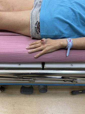 ▲▼《繞著地球跑》李秀媛出車禍！骨裂脫臼送醫。（圖／翻攝自臉書）