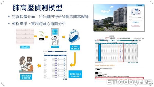 北榮完成全球首款跨國、跨中心驗證的「心電圖肺高壓偵測系統」。（圖／北榮提供）
