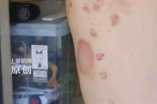 ▲程先生不適就醫。（圖／翻攝自微博）