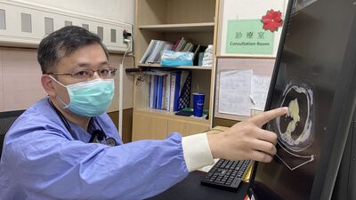 她背痛竟是主動脈剝離險喪命　夏季好發3大危險因素一次看