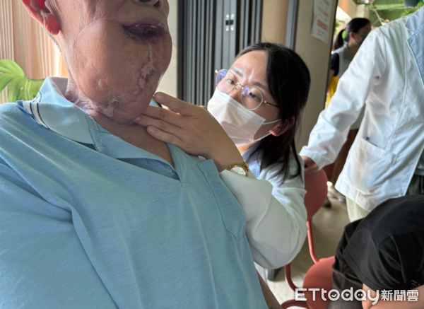 ▲門諾醫院癌症資源中心與陽光基金會合辦「頭頸癌病友回娘家」活動。(圖門諾醫院提供下同)